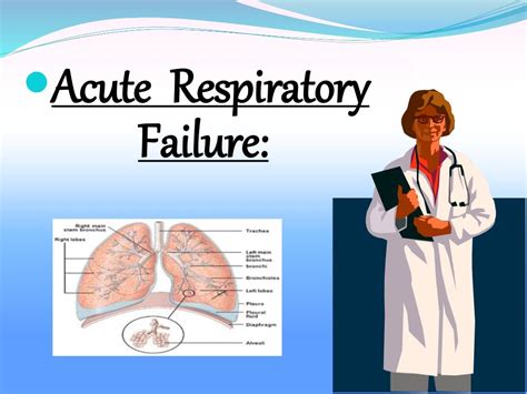 ryan gasacao|Acute respiratory failure in a rapidly.